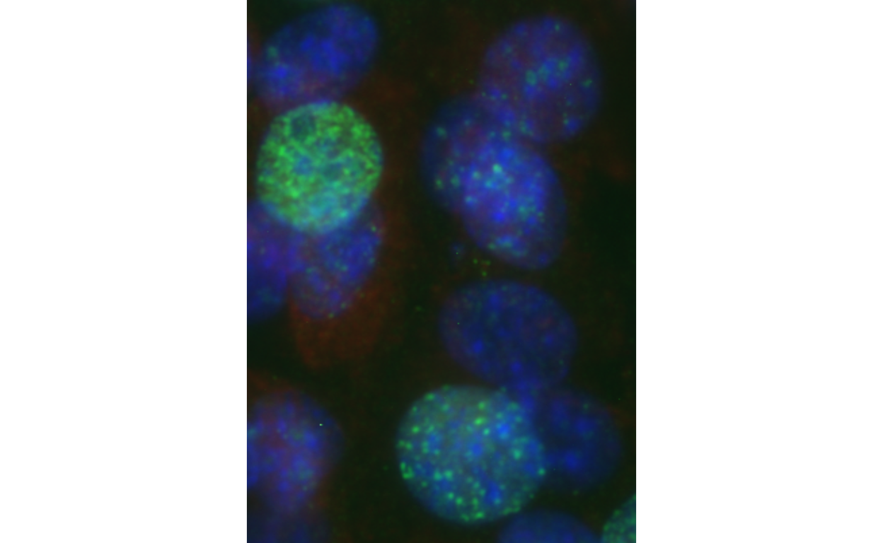 Application Example of the image2data Package: The image displays nuclei stained with DAPI (blue) and a quantitative marker for DNA double strand breaks, was labeled with a specific antibody (green). The image2data package extracted 20% of the pixels from the original image (top), creating a table with x|y coordinates and corresponding hex color codes. This data was then used to reassemble the image using R’s base plot (bottom).