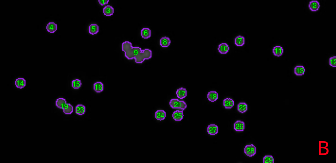 Microbead Detection using biopixR: A) The original image shows red fluorescent microbeads, with the majority appearing as isolated, round, spherical objects. Some microbeads are clustered together or overlapping, forming aggregated structures, while others are partially captured within the image frame. B) In the grayscale microbead image, edges of the microbeads are highlighted in purple, and the labeling ID (value) is displayed at the center of each object in green.