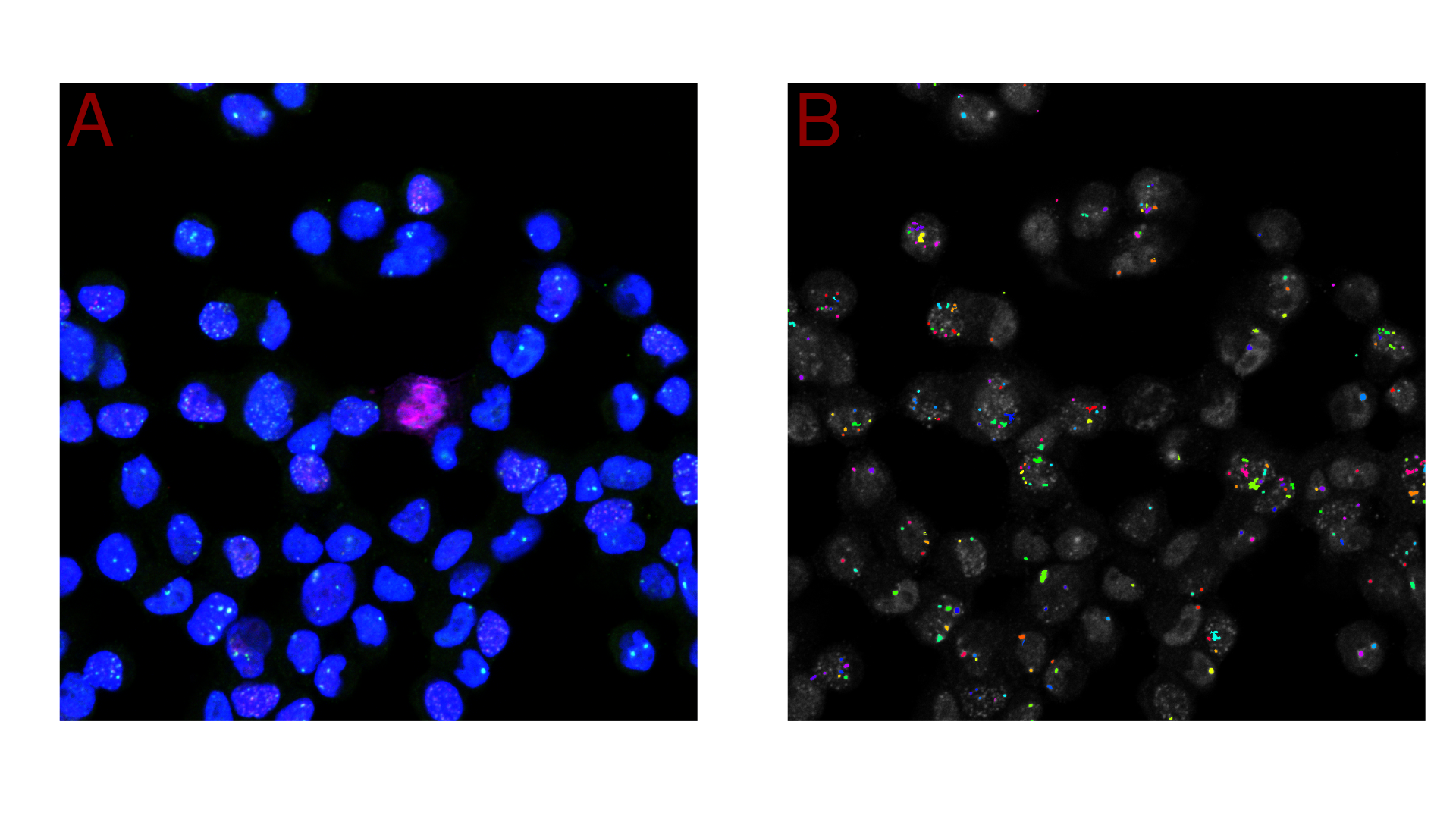 Quantification of DNA Double Strand Breaks: A) The image displays cells with nuclei stained using DAPI. The quantitative marker for DNA double strand breaks, \(\gamma\)H2AX, targeted with a specific antibody, is visible as green fluorescent foci. The experimental procedure follows the method described by Rödiger et al. (2018). B) The \(\gamma\)H2AX foci are quantified using the biopixR package. The detected foci are highlighted in different colors using the changePixelColor() function.